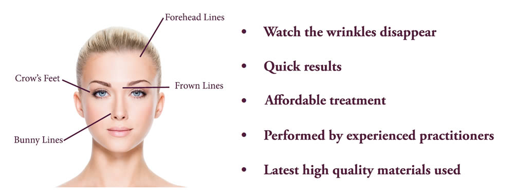 Botox treatment